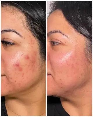 Forever Young Aesthetics, spa, Irving